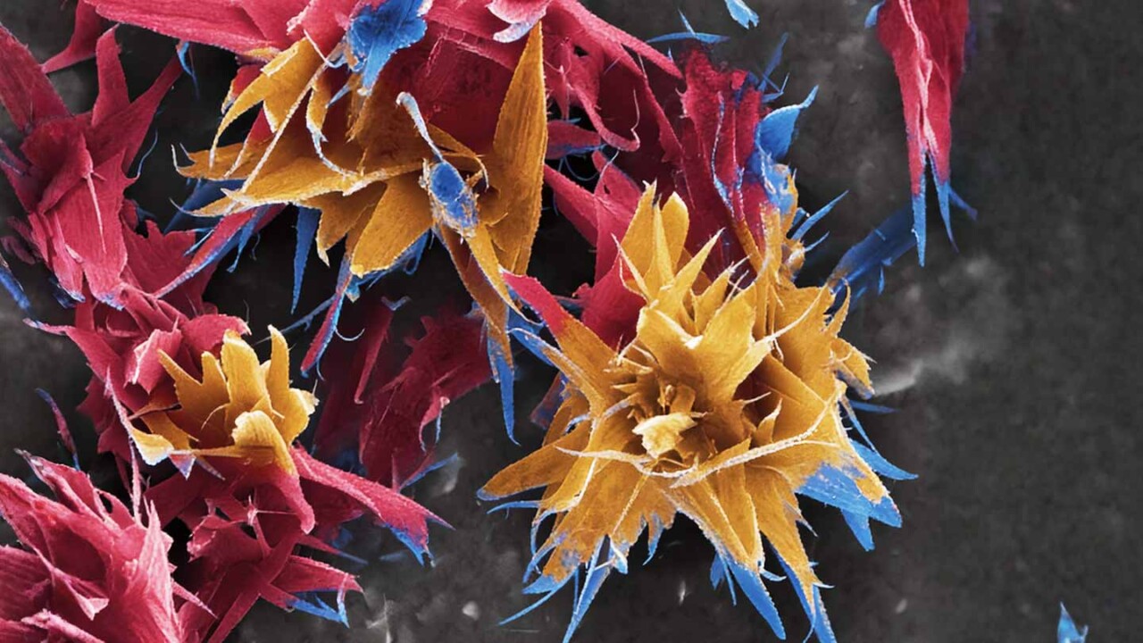 Farbig kontrastierte mikroskopische Aufnahme (z. B. REM/SEM) mit faserigen und schichtartigen Partikelstrukturen in Rot, Gelb und Blau vor dunklem Hintergrund. Das Bild visualisiert die Mikrostruktur eines Materials bzw. einer Lebensmittelmatrix und steht für hochauflösende Struktur- und Materialanalytik im Zentrum für Lebensmittelphysik (ZLP).