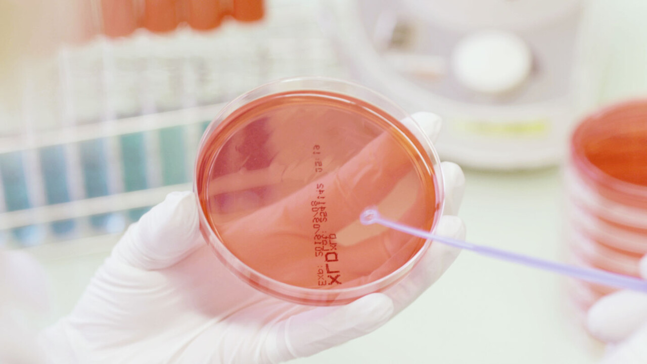 Nahaufnahme einer gloved Hand im Labor, die eine Petrischale mit rötlichem Nährmedium hält. Mit einem sterilen Tupfer wird eine Probe aufgetragen – Symbolbild für chemisch-analytische Untersuchungen, Qualitätskontrolle sowie Sicherheit und Authentizität von Lebensmitteln.